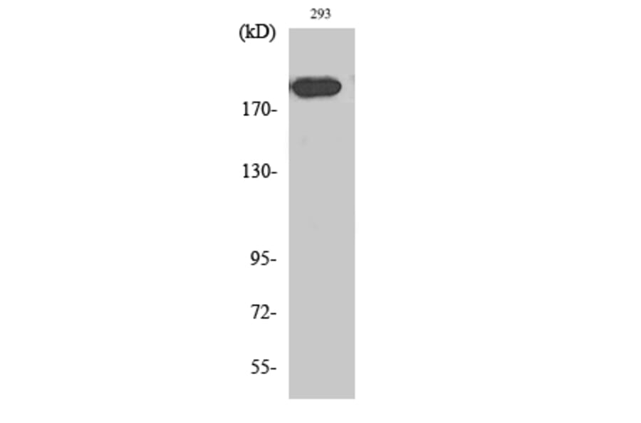 Western blot - Endo180 Polyclonal Antibody from Signalway Antibody (40881) - Antibodies.com