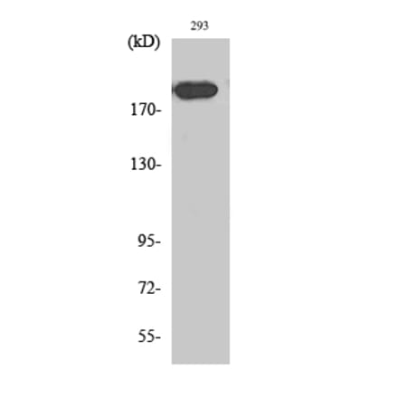 Western blot - Endo180 Polyclonal Antibody from Signalway Antibody (40881) - Antibodies.com