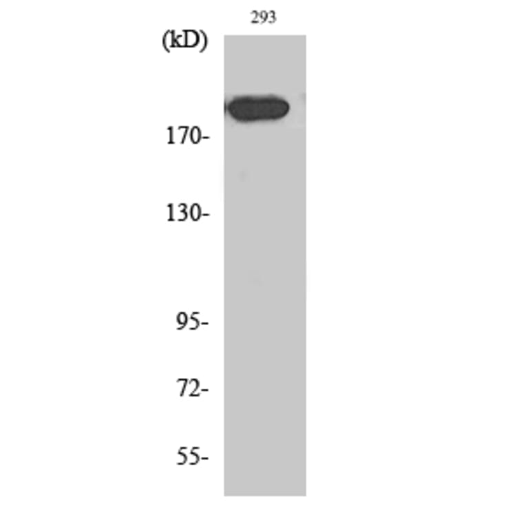 Western blot - Endo180 Polyclonal Antibody from Signalway Antibody (40881) - Antibodies.com