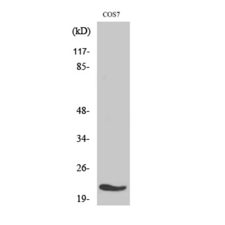 Western blot - MRP-L11 Polyclonal Antibody from Signalway Antibody (41168) - Antibodies.com