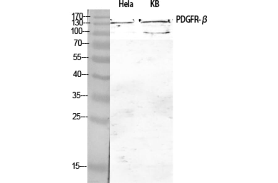 Western blot - PDGFR-β Polyclonal Antibody from Signalway Antibody (41327) - Antibodies.com