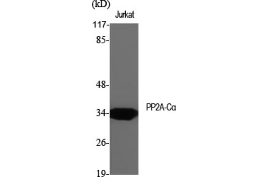 Western blot - PP2A-Cα Polyclonal Antibody from Signalway Antibody (41357) - Antibodies.com