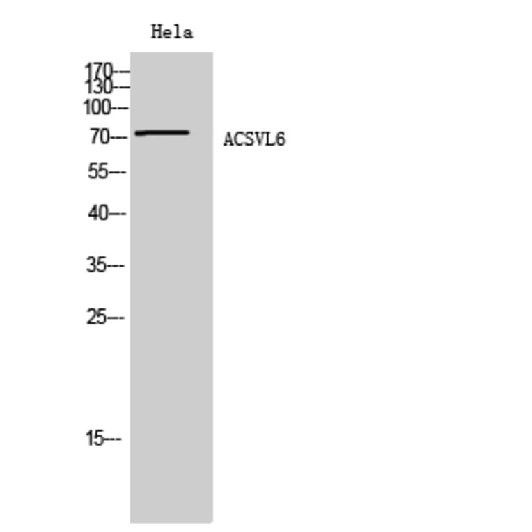 Western blot - ACSVL6 Polyclonal Antibody from Signalway Antibody (40548) - Antibodies.com