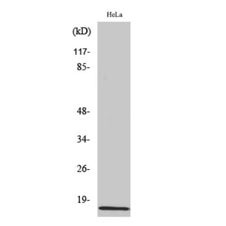 Western blot - Amylin Polyclonal Antibody from Signalway Antibody (40586) - Antibodies.com