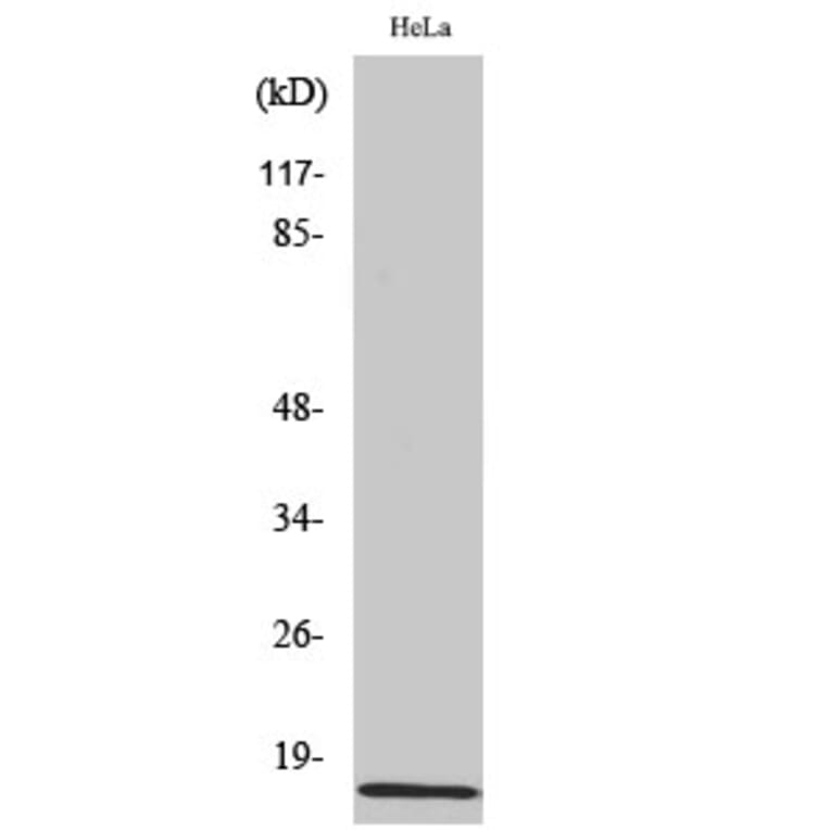 Western blot - Amylin Polyclonal Antibody from Signalway Antibody (40586) - Antibodies.com