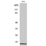 Western blot - Amylin Polyclonal Antibody from Signalway Antibody (40586) - Antibodies.com