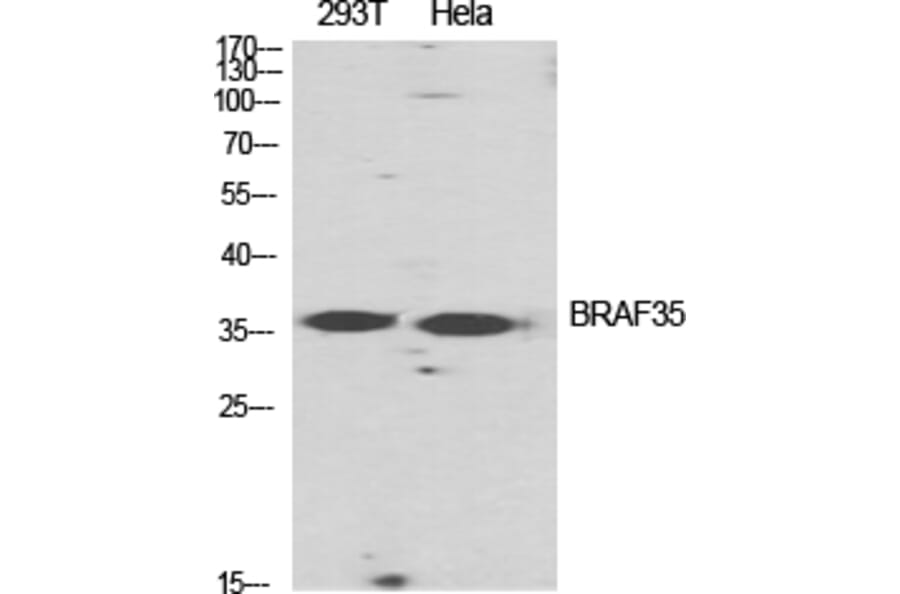 Western blot - BRAF35 Polyclonal Antibody from Signalway Antibody (40653) - Antibodies.com