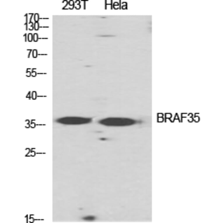 Western blot - BRAF35 Polyclonal Antibody from Signalway Antibody (40653) - Antibodies.com