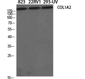 Western blot - COL1A2 Polyclonal Antibody from Signalway Antibody (40771) - Antibodies.com