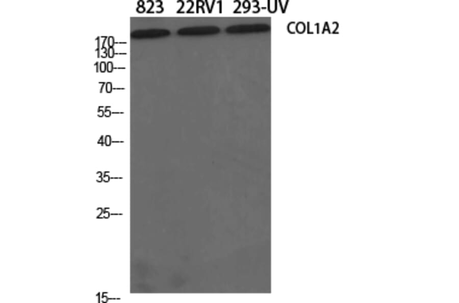 Western blot - COL1A2 Polyclonal Antibody from Signalway Antibody (40771) - Antibodies.com