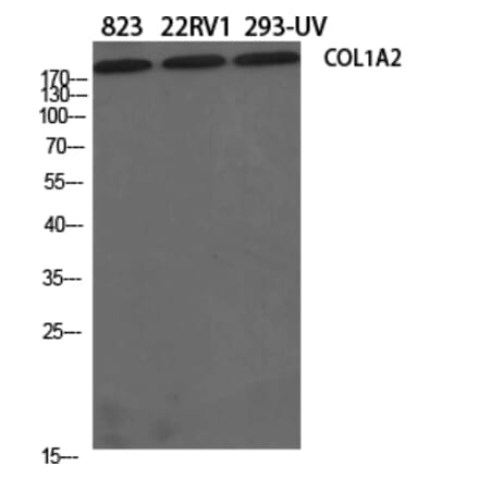 Western blot - COL1A2 Polyclonal Antibody from Signalway Antibody (40771) - Antibodies.com