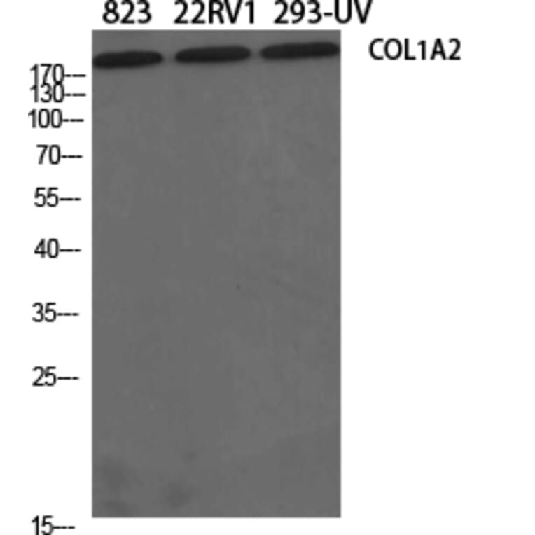 Western blot - COL1A2 Polyclonal Antibody from Signalway Antibody (40771) - Antibodies.com