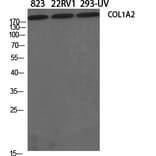 Western blot - COL1A2 Polyclonal Antibody from Signalway Antibody (40771) - Antibodies.com