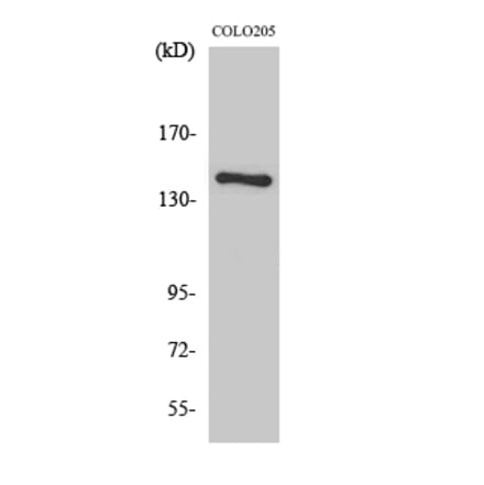 Western blot - COL2A1 Polyclonal Antibody from Signalway Antibody (40772) - Antibodies.com