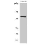 Western blot - COL2A1 Polyclonal Antibody from Signalway Antibody (40772) - Antibodies.com