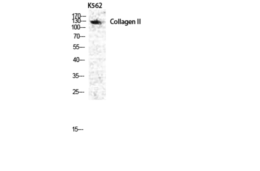 Western blot - COL2A1 Polyclonal Antibody from Signalway Antibody (40772) - Antibodies.com