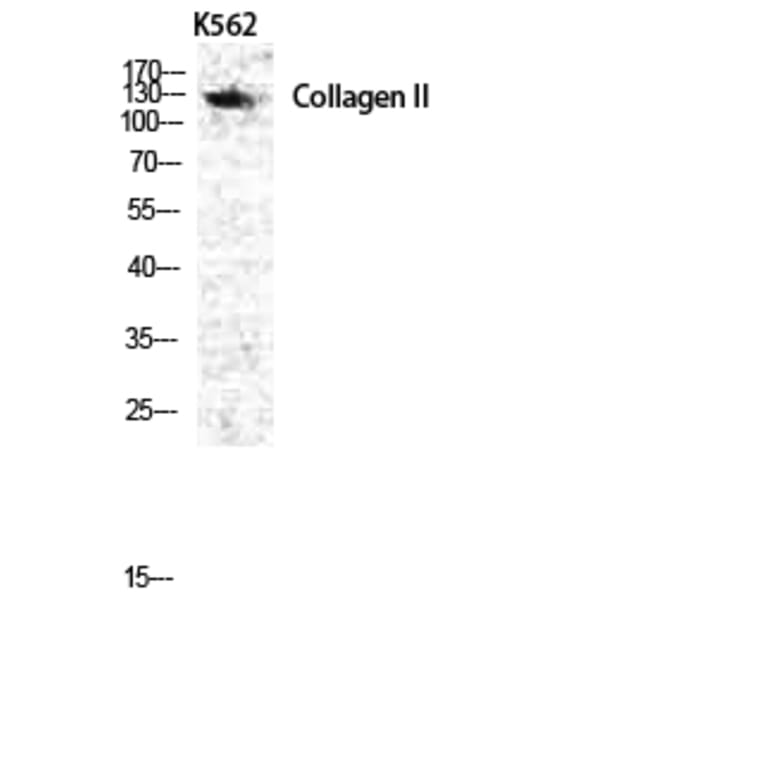 Western blot - COL2A1 Polyclonal Antibody from Signalway Antibody (40772) - Antibodies.com