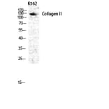 Western blot - COL2A1 Polyclonal Antibody from Signalway Antibody (40772) - Antibodies.com