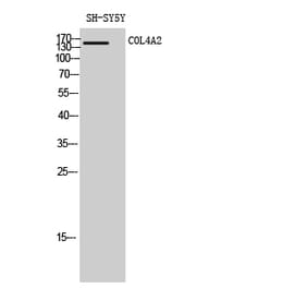 Western blot - COL4A2 Polyclonal Antibody from Signalway Antibody (40774) - Antibodies.com