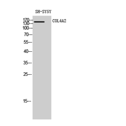 Western blot - COL4A2 Polyclonal Antibody from Signalway Antibody (40774) - Antibodies.com