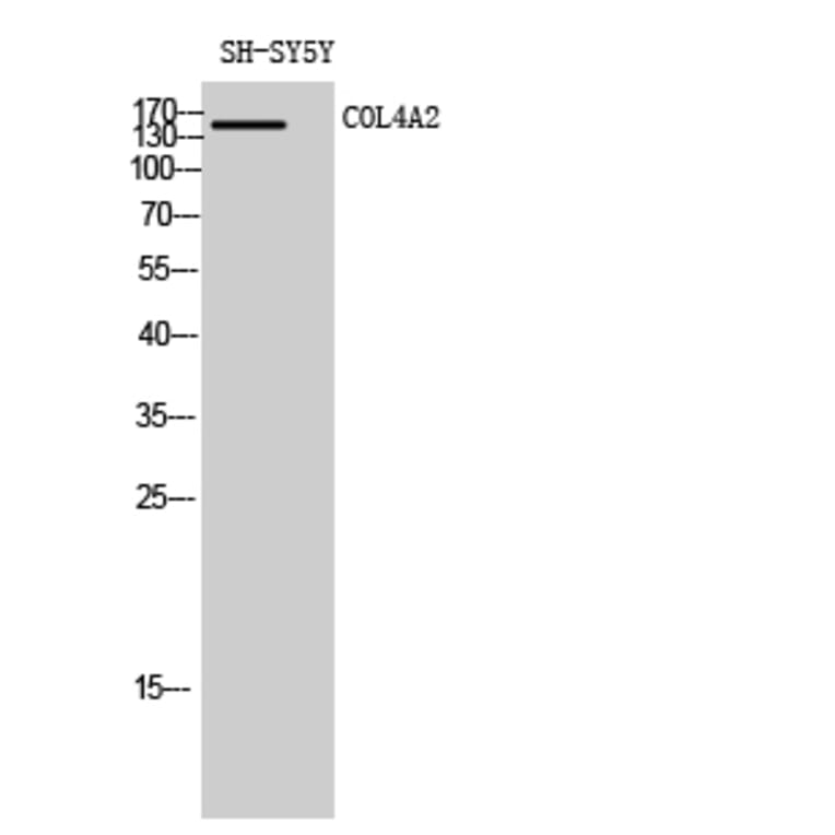 Western blot - COL4A2 Polyclonal Antibody from Signalway Antibody (40774) - Antibodies.com