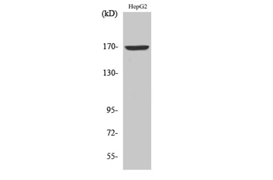 Western blot - COL4A6 Polyclonal Antibody from Signalway Antibody (40775) - Antibodies.com