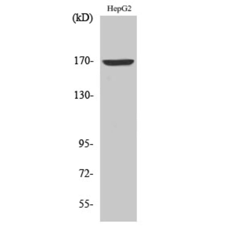 Western blot - COL4A6 Polyclonal Antibody from Signalway Antibody (40775) - Antibodies.com