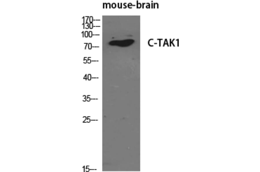 Western blot - C-TAK1 Polyclonal Antibody from Signalway Antibody (40793) - Antibodies.com