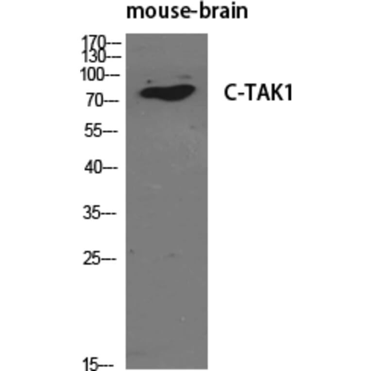 Western blot - C-TAK1 Polyclonal Antibody from Signalway Antibody (40793) - Antibodies.com