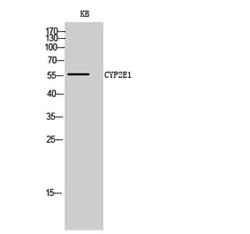 Western blot - CYP2E1 Polyclonal Antibody from Signalway Antibody (40815) - Antibodies.com