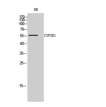 Western blot - CYP2E1 Polyclonal Antibody from Signalway Antibody (40815) - Antibodies.com