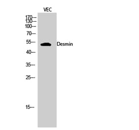 Western blot - Desmin Polyclonal Antibody from Signalway Antibody (40839) - Antibodies.com