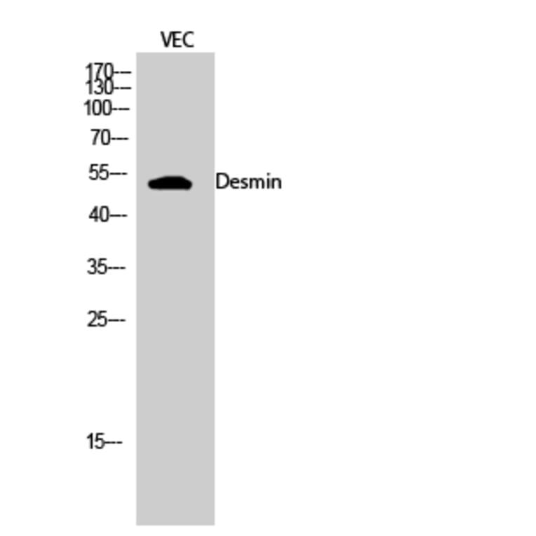 Western blot - Desmin Polyclonal Antibody from Signalway Antibody (40839) - Antibodies.com