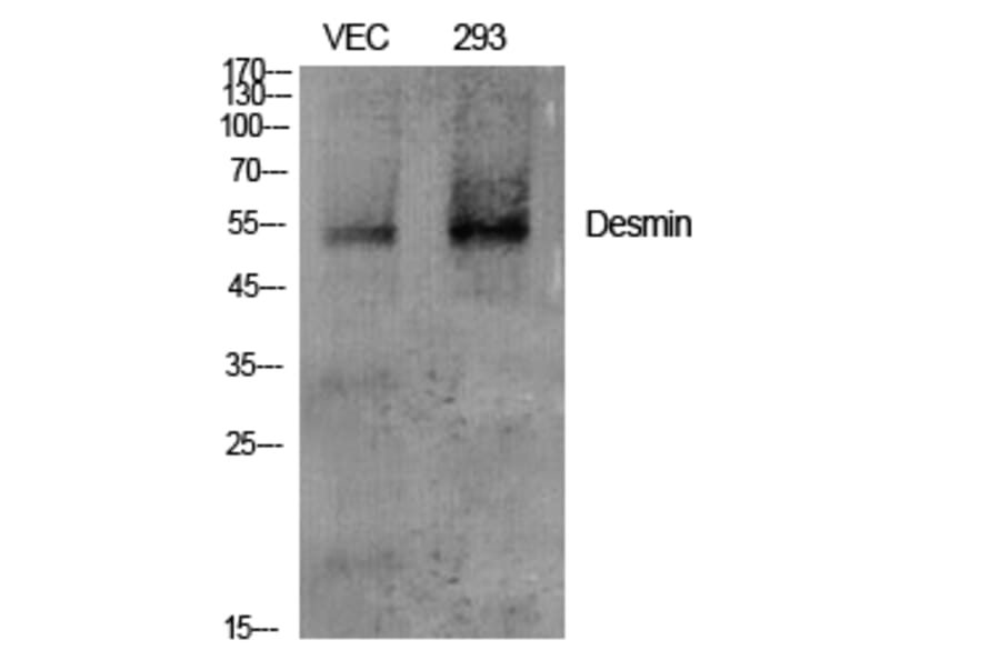 Western blot - Desmin Polyclonal Antibody from Signalway Antibody (40839) - Antibodies.com