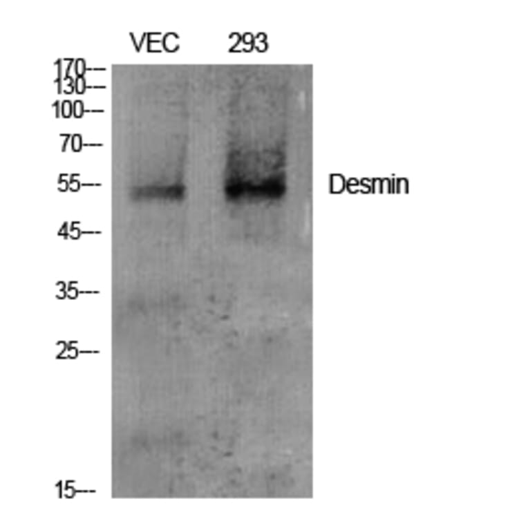 Western blot - Desmin Polyclonal Antibody from Signalway Antibody (40839) - Antibodies.com