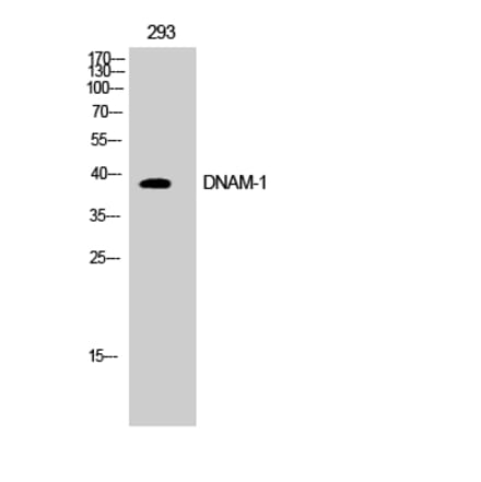 Western blot - DNAM-1 Polyclonal Antibody from Signalway Antibody (40846) - Antibodies.com