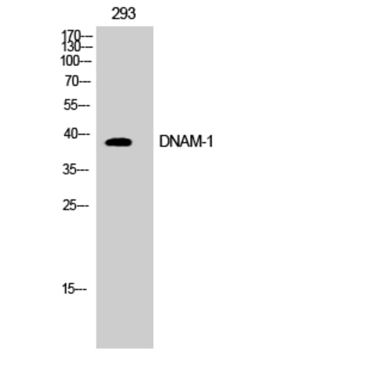 Western blot - DNAM-1 Polyclonal Antibody from Signalway Antibody (40846) - Antibodies.com