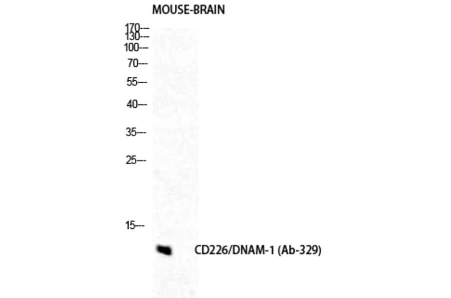 Western blot - DNAM-1 Polyclonal Antibody from Signalway Antibody (40846) - Antibodies.com