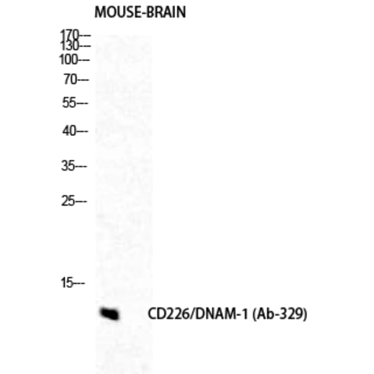 Western blot - DNAM-1 Polyclonal Antibody from Signalway Antibody (40846) - Antibodies.com