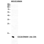 Western blot - DNAM-1 Polyclonal Antibody from Signalway Antibody (40846) - Antibodies.com