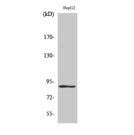 Western blot - Dyrk1A Polyclonal Antibody from Signalway Antibody (40858) - Antibodies.com