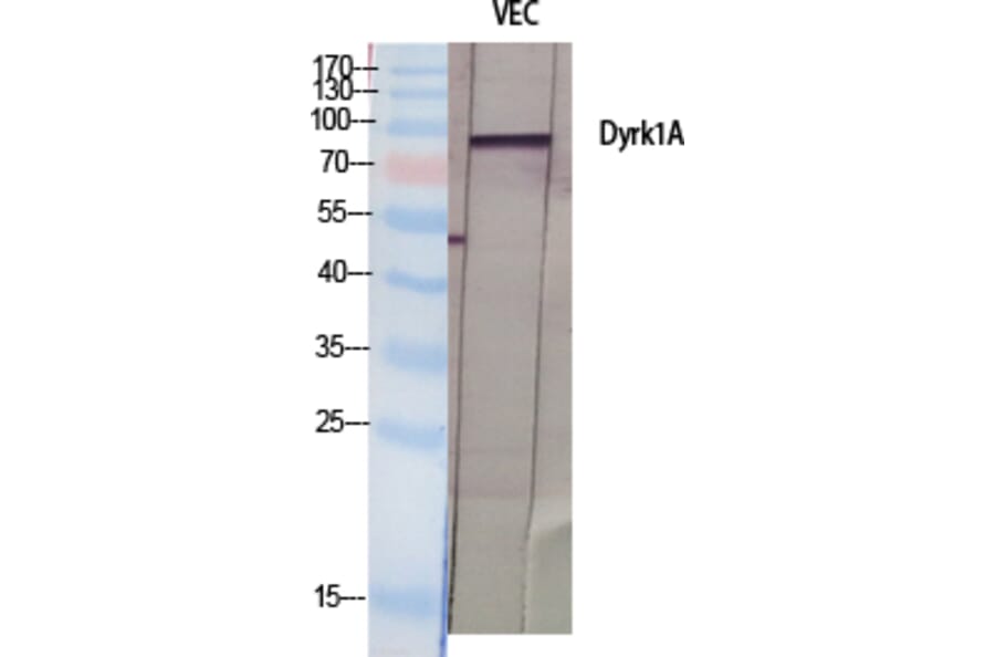 Western blot - Dyrk1A Polyclonal Antibody from Signalway Antibody (40858) - Antibodies.com