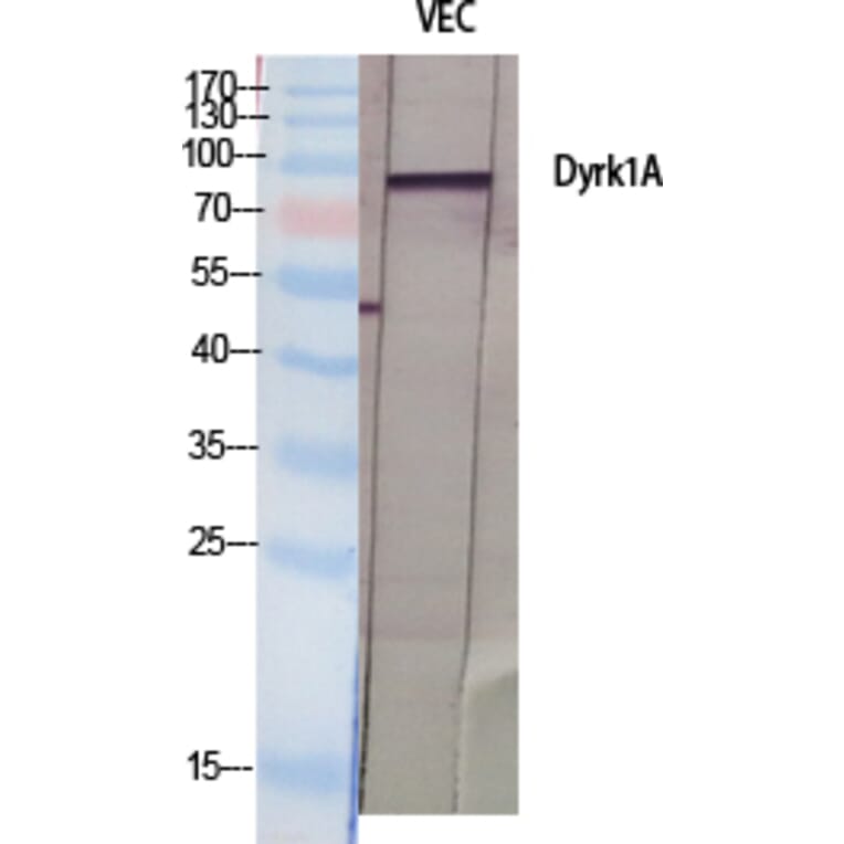 Western blot - Dyrk1A Polyclonal Antibody from Signalway Antibody (40858) - Antibodies.com