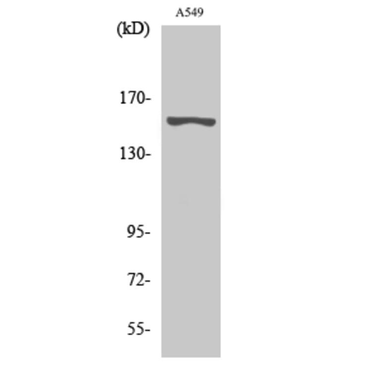 Western blot - GPR116 Polyclonal Antibody from Signalway Antibody (40972) - Antibodies.com