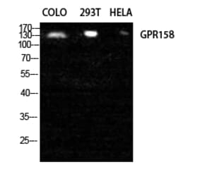 Western blot - GPR158 Polyclonal Antibody from Signalway Antibody (40977) - Antibodies.com