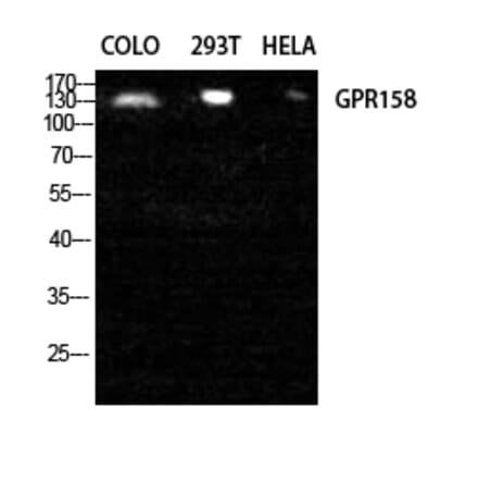 Western blot - GPR158 Polyclonal Antibody from Signalway Antibody (40977) - Antibodies.com