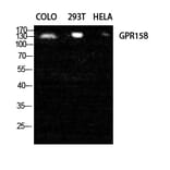 Western blot - GPR158 Polyclonal Antibody from Signalway Antibody (40977) - Antibodies.com