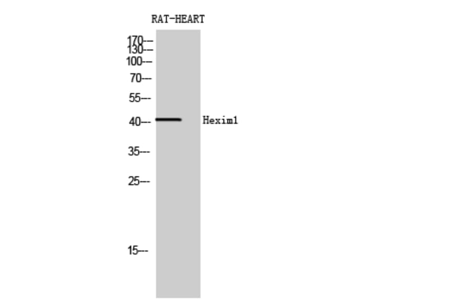 Western blot - Hexim1 Polyclonal Antibody from Signalway Antibody (41004) - Antibodies.com