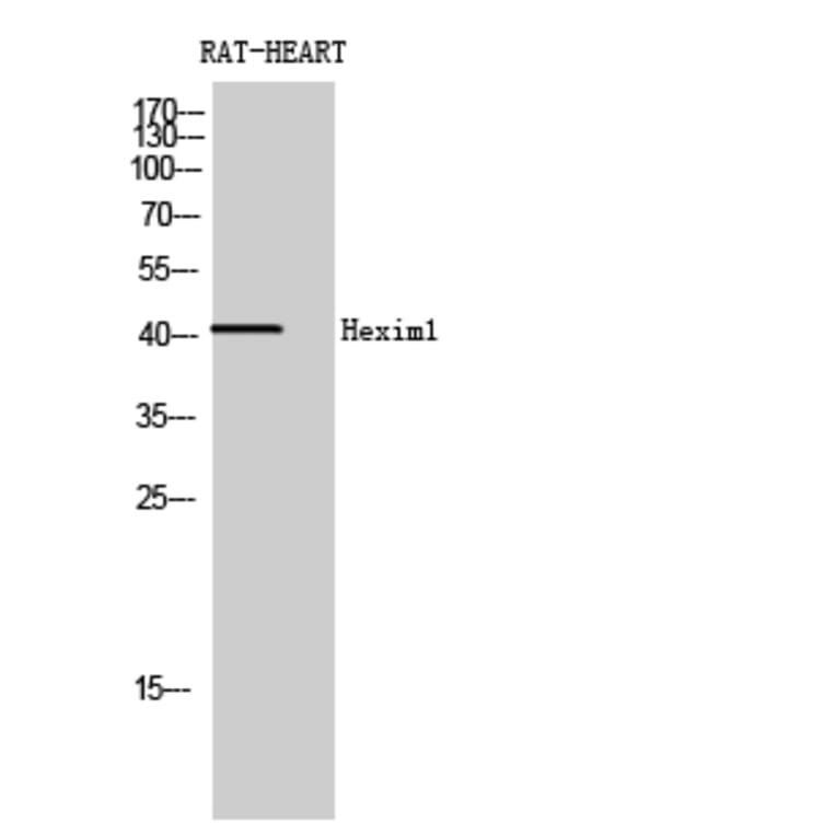 Western blot - Hexim1 Polyclonal Antibody from Signalway Antibody (41004) - Antibodies.com