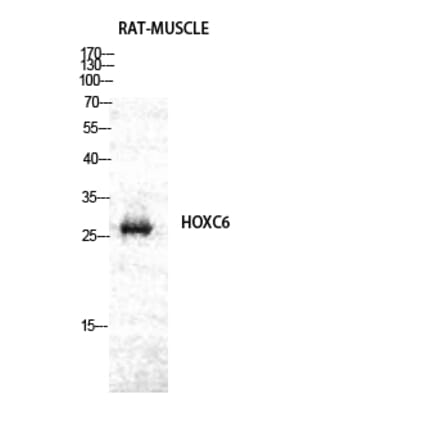 Western blot - Hox-C6 Polyclonal Antibody from Signalway Antibody (41032) - Antibodies.com